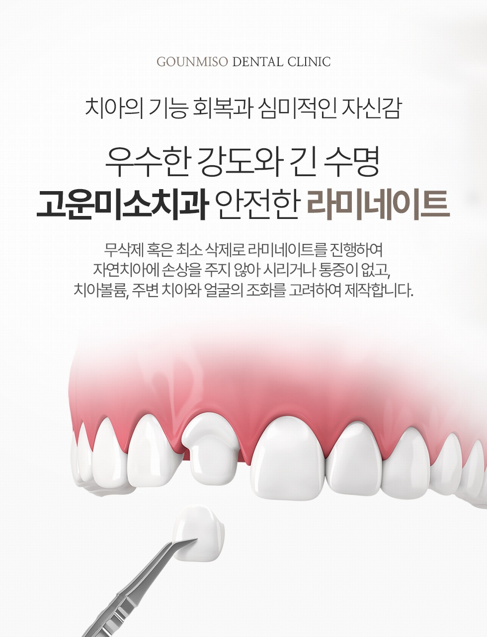 치아의 기능 회복과 심미적인 자신감